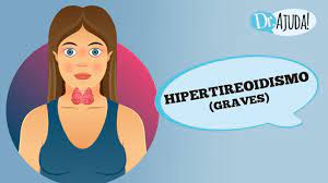 Hipertireoidismo e doença de graves: quais os sintomas e tratamento